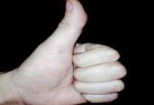 從手相疤痕看你要注意什么