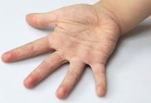 什么手相會(huì)影響婚姻生活