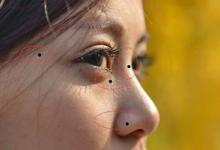 臉上哪些痣必須點掉圖解,對自身有什么影響