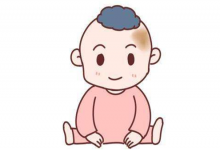 最有福氣的十處胎記,看看你有沒有