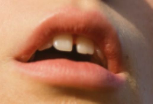 夢見掉了兩顆上門牙是什么意思 夢見掉了兩顆上門牙有什么征兆