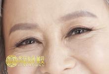 皺紋面相性格分析