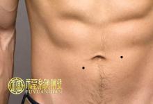 男人肚子痣相圖解分析