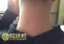 苦情痣怎么尋前世戀人