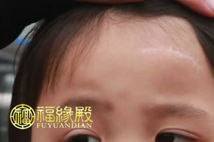面相有疤 額頭有疤面相(圖文)