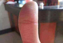 鳳眼紋一端未閉合，這種手相好不好呢