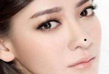 山根有痣會不會影響事業運勢?