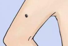 女人手臂有痣保富貴,你有嗎?