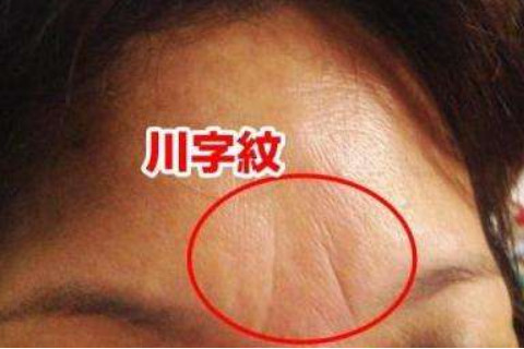 注意：額頭有豎紋，對你的命運大有幫助