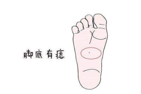 面相分析:男人女人腳底有一顆痣是有什么說法