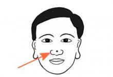 男人鼻尖有痣是有什么樣的說法,會是什么樣的命運