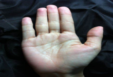 免費教你手相看病，準到離譜