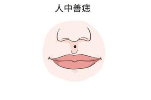 面相分析:人中附近有痣代表了什么?