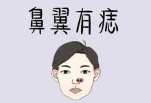 鼻翼有痣的人命運(yùn)好不好