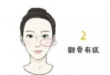 女人顴骨有痣代表什么意思