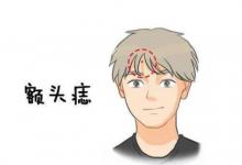 天庭有痣的人命運(yùn)如何