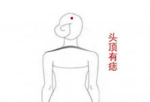 四種可以帶來福運的痣