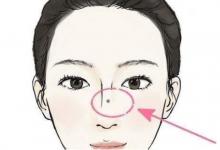 臉上活痣痣相分析