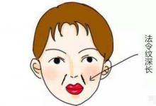 法令紋不對稱面相分析