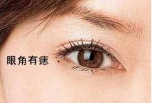 富貴的痣相特征