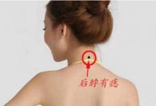 脖子有痣的人怎么樣