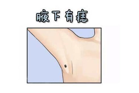 痣相占卜哪些是福痣?