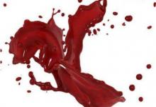 女人夢(mèng)見月經(jīng)血