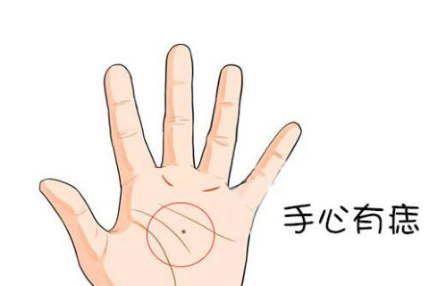 手掌有痣面相圖解