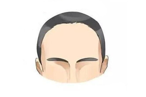 有福的額頭有哪些呢?