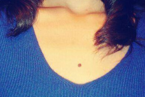 胸前長痣面相圖解