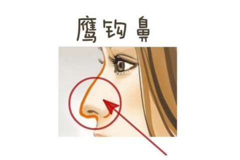 鷹鉤鼻面相分析