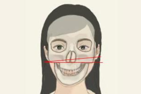 左右臉不對稱的影響有哪些?