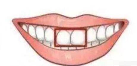 八字形門牙圖片