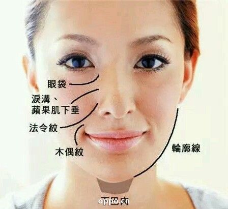 鼻翼兩側八字紋_女性鼻翼兩側長斑_鼻翼兩側長斑