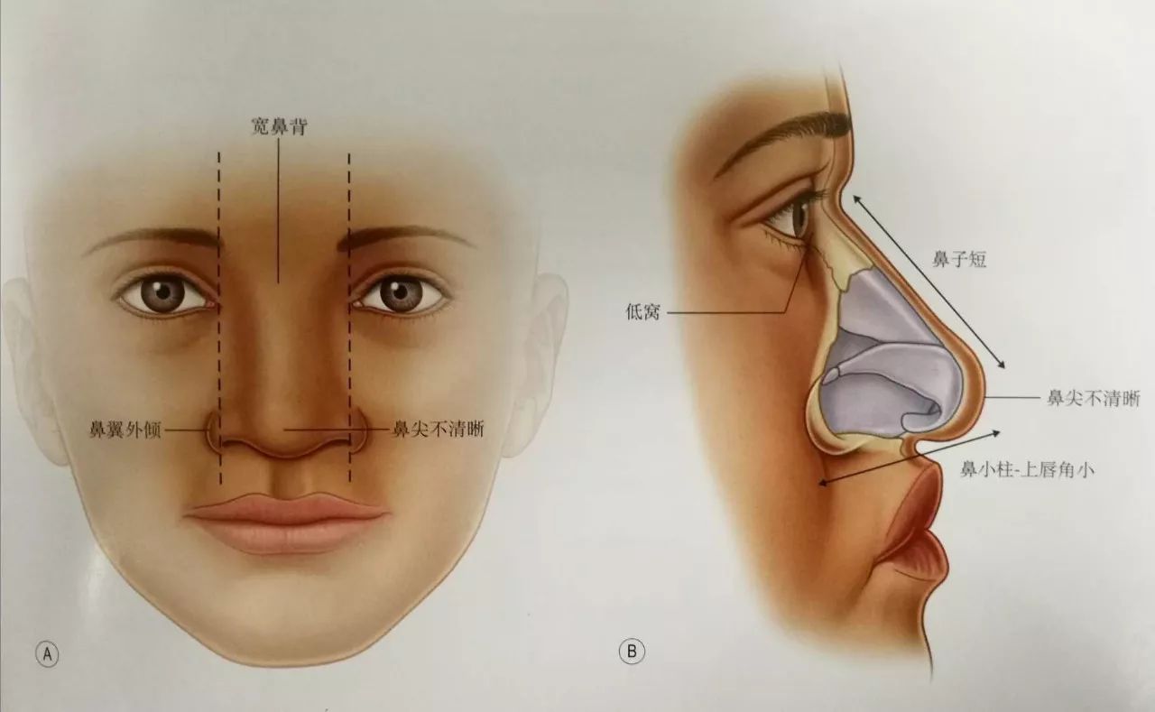 易海星空網(wǎng)免費(fèi)測八字_老易鼻孔八字型_易奇八字合婚免費(fèi)測試