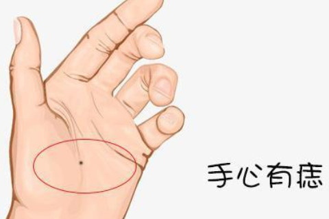 女人左手心長痣好不好?