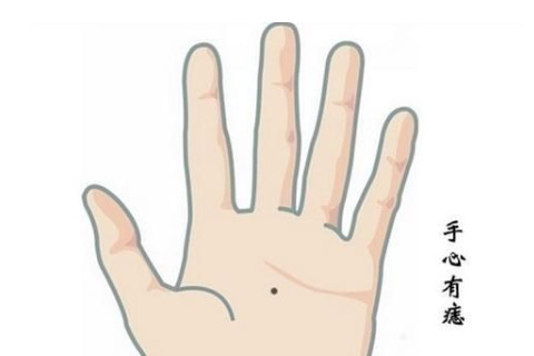 手掌痣相代表了什么命運?