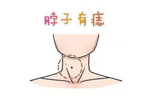 脖子上有三顆痣的人好不好?