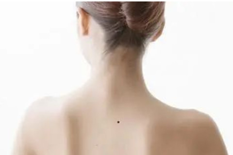 女人后背長痣有什么含義?
