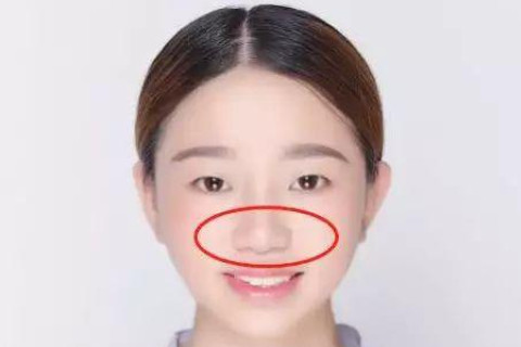 鼻梁有疤面相好不好?