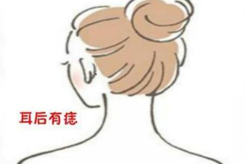 耳朵后面有痣代表什么?