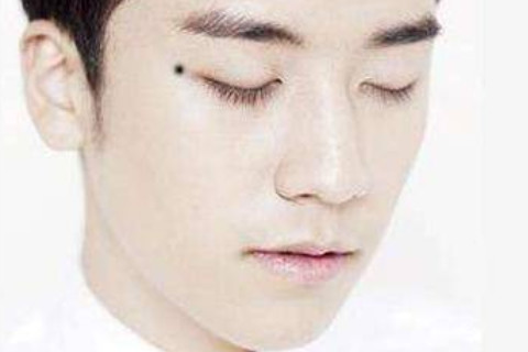 男人眼角有活痣這種面相代表什么命運?