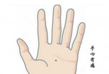 手掌痣相代表了什么命運?