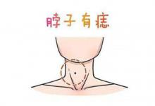 脖子上有三顆痣的人好不好?