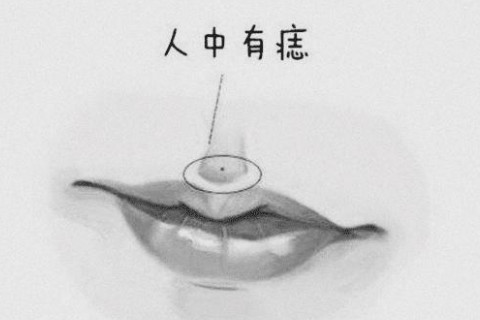 人中有痣的女人幸運嗎?