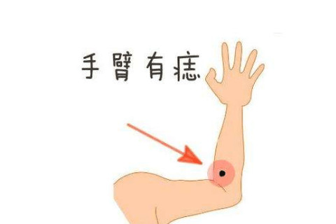 手臂有痣的女人旺夫嗎?