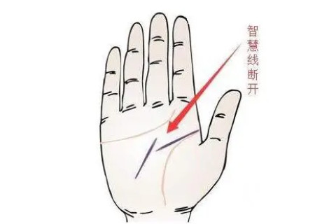 智慧線中斷的人好不好?