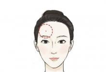 額頭兩側(cè)長痣好不好?