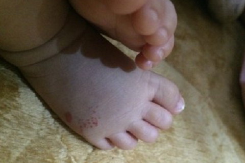 胎記長(zhǎng)在嘴唇上好嗎?在嘴巴邊有福氣