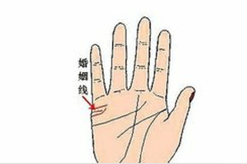 小拇指長痣的位置和命運?小拇指長痣好不好